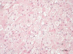 Corpus luteum in domestic cat (picture: Leibniz-IZW) Corpus luteum in domestic cat (picture: Leibniz-IZW)