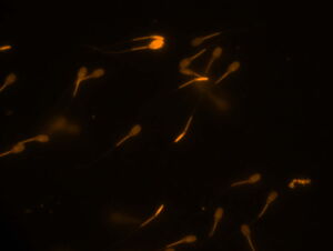 Eber-Spermien, Foto: K. Müller, Leibniz-IZW Eber-Spermien, Foto: K. Müller, Leibniz-IZW