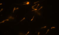 Eber-Spermien, Foto: K. Müller, Leibniz-IZW