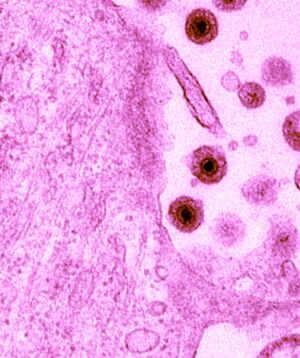 Equine herpesvirus, Author: Walid A / Leibniz-IZW Equine herpesvirus, Author: Walid A / Leibniz-IZW