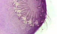 Head of a tapeworm Taenia sp. Picture: I. Lesniak/Leibniz-IZW