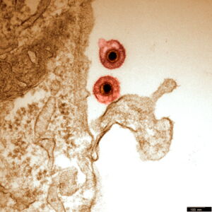 Equine herpes virus (EHV). Photo: Walid Azab