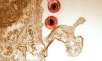 Equine herpes virus (EHV). Photo: Walid Azab