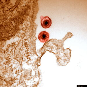 Herpesvirus particles. Photo: Walid Azab Herpesvirus particles. Photo: Walid Azab