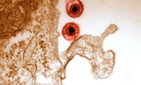 Herpesvirus particles. Photo: Walid Azab