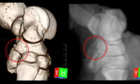 Synchronised computed tomography (CT) - digital radiography (DR), the principle of method... Photo: Galateanu/IZW