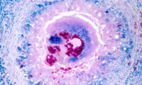 TEM-Aufnahme: Tuberkulose-Granulom mit Mykobakterien. Foto: Gudrun Wibbelt/ IZW