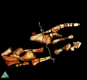 Virtual reconstruction of bones of Dysalotosaurus from one of the bamboo corsets (Image: Leibniz-IZW, MfN, Charite)