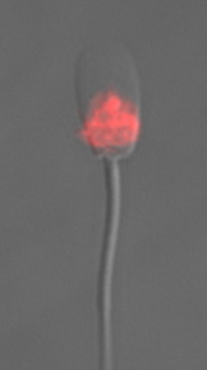 Markiertes Eber-Spermium, Foto: P. Kroh, Leibniz-IZW Markiertes Eber-Spermium, Foto: P. Kroh, Leibniz-IZW