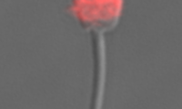 Markiertes Eber-Spermium, Foto: P. Kroh, Leibniz-IZW