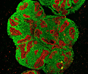 Brain organoid from Sumatran rhino stem cells (photo: Silke Frahm-Barske/Max Delbrück Center) Brain organoid from Sumatran rhino stem cells (photo: Silke Frahm-Barske/Max Delbrück Center)